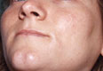 Face post