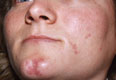 Face pre